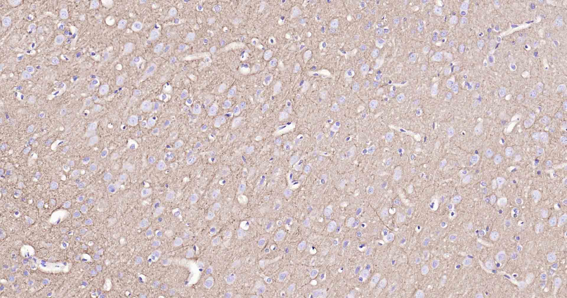 钠钾ATP酶蛋白a1单克隆抗体-bsm-34014M