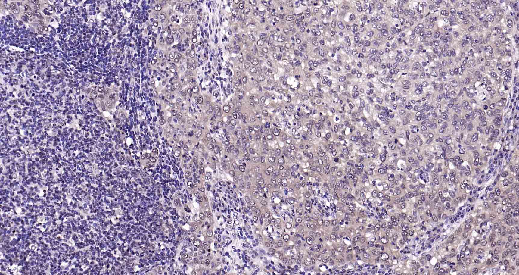 Rad51重组兔单抗