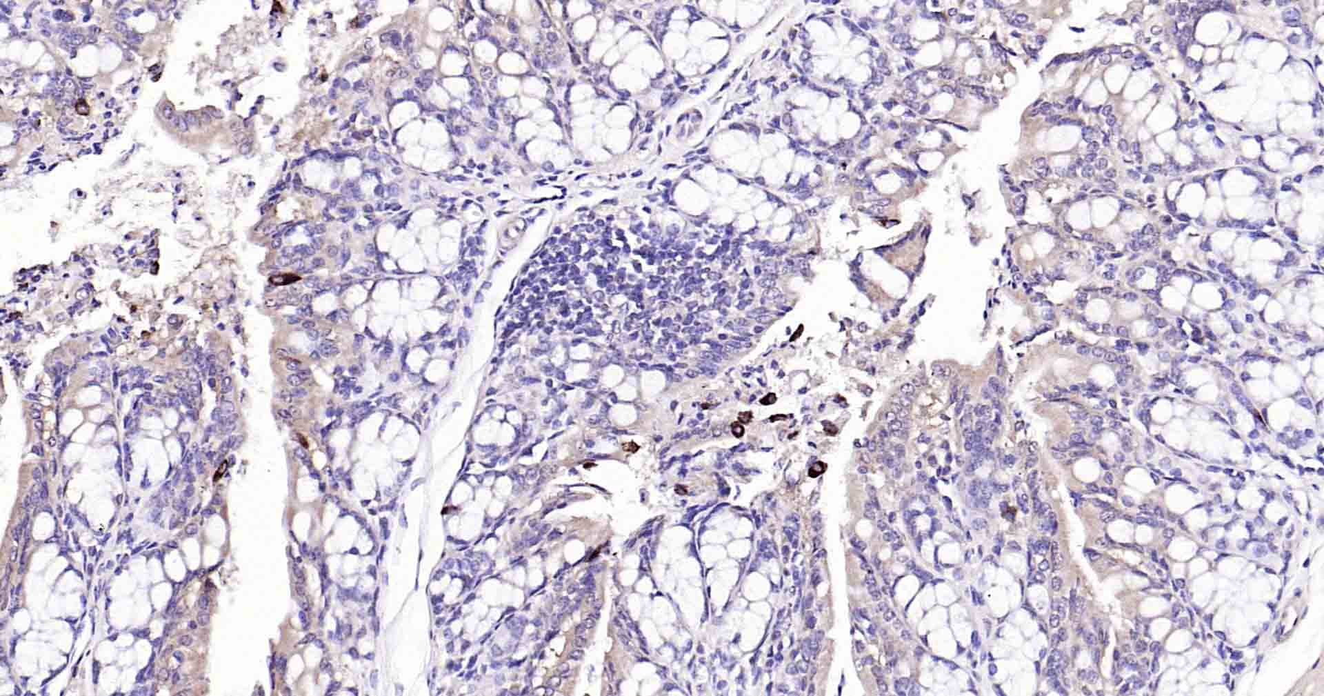 自噬效应蛋白Beclin 1重组兔单抗