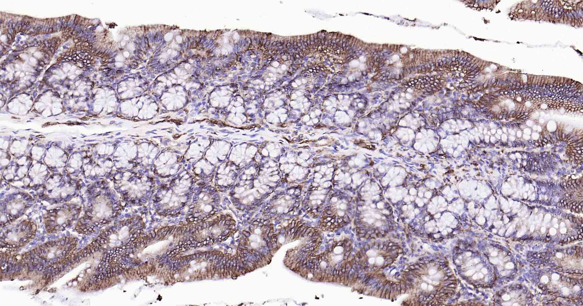钠钾ATP酶蛋白a1单克隆抗体-bsm-34014M