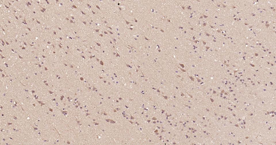 GADD153抗体-bs-1361R