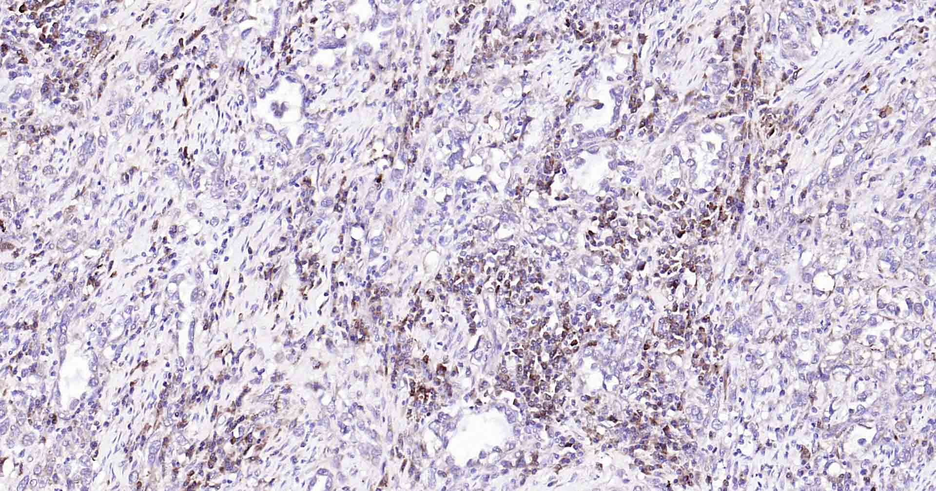 自噬效应蛋白Beclin 1重组兔单抗
