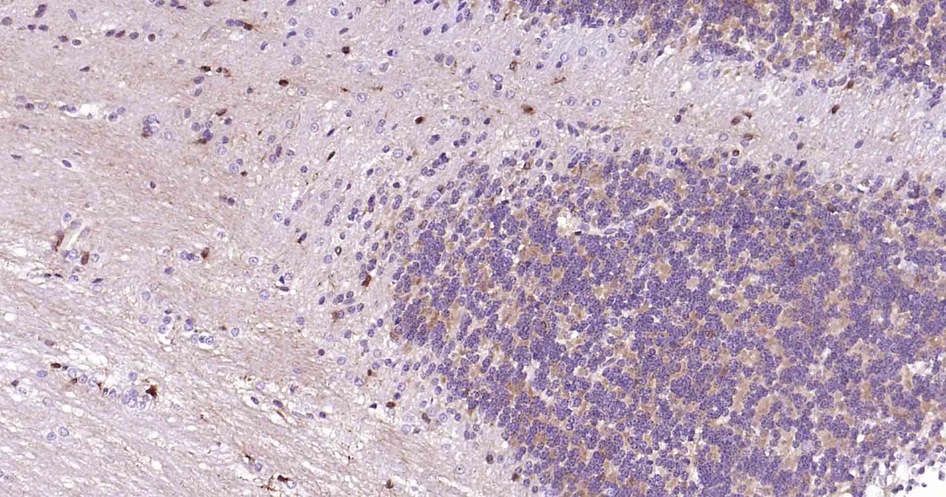 神经元特异性烯醇化酶/γ 烯醇化酶重组兔单克隆抗体