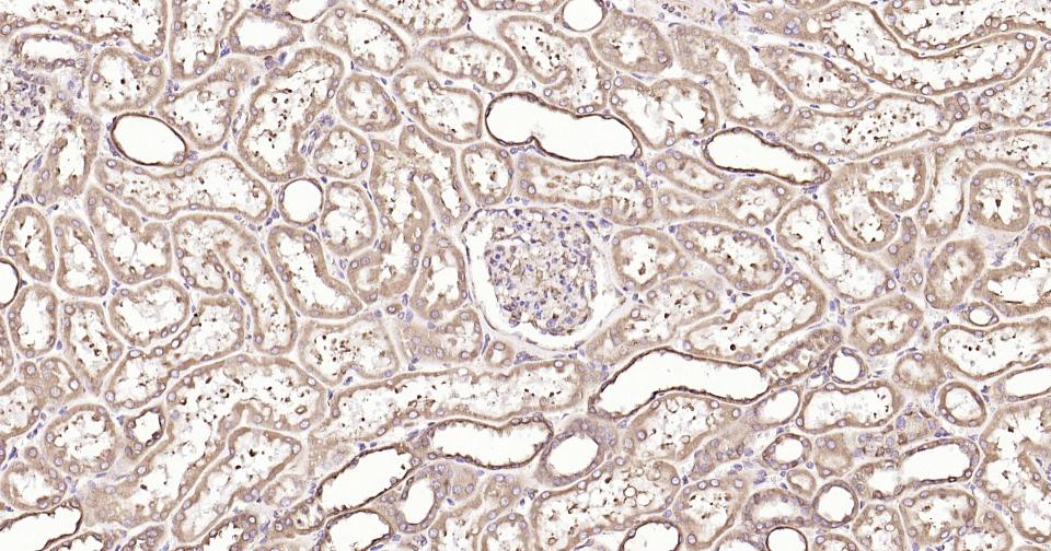 钙网蛋白重组兔单抗