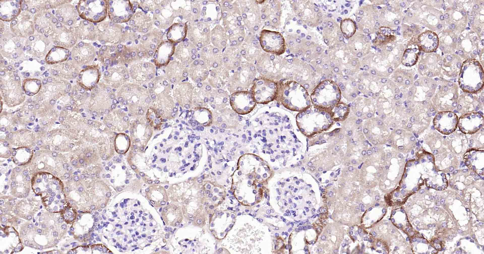 自噬效应蛋白Beclin 1重组兔单抗
