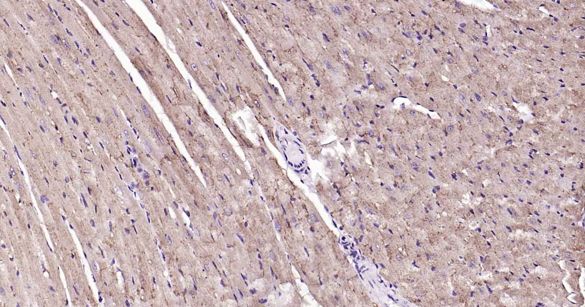 钠钾ATP酶蛋白b1重组兔单抗-bsm-61065R