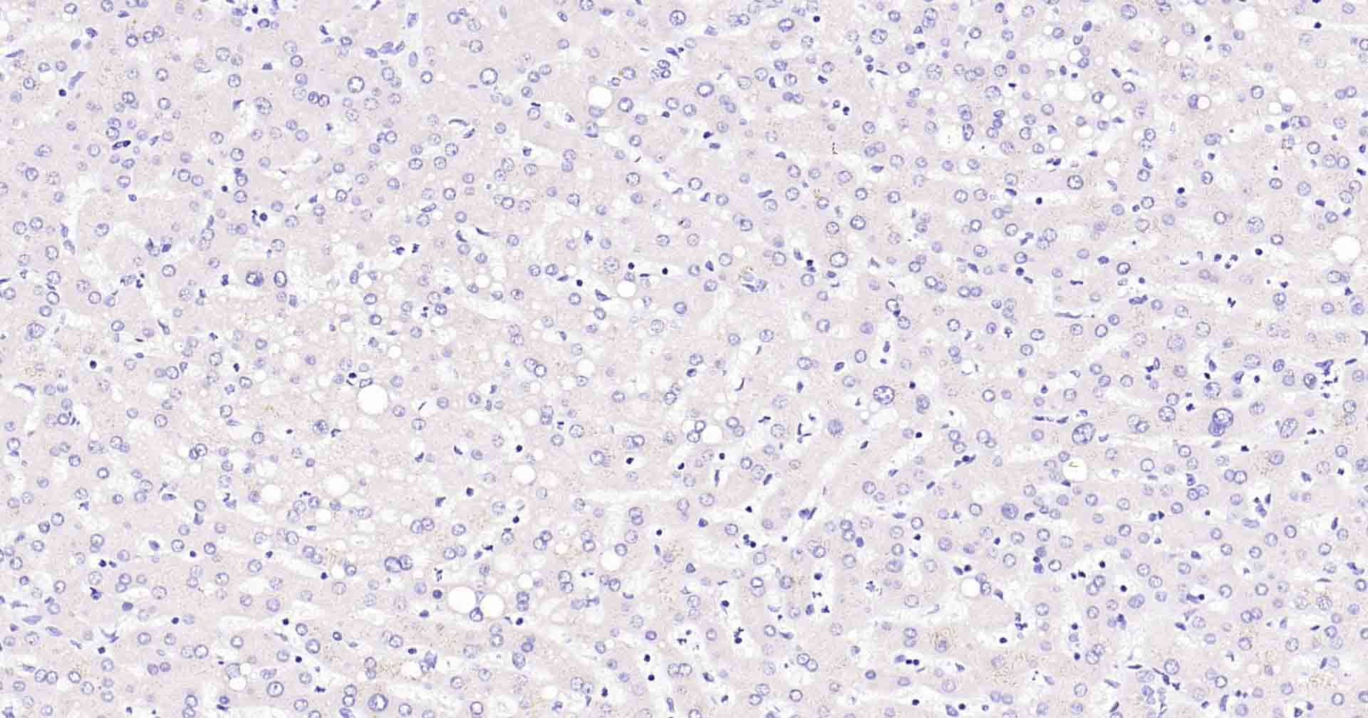 胰岛素重组兔单抗