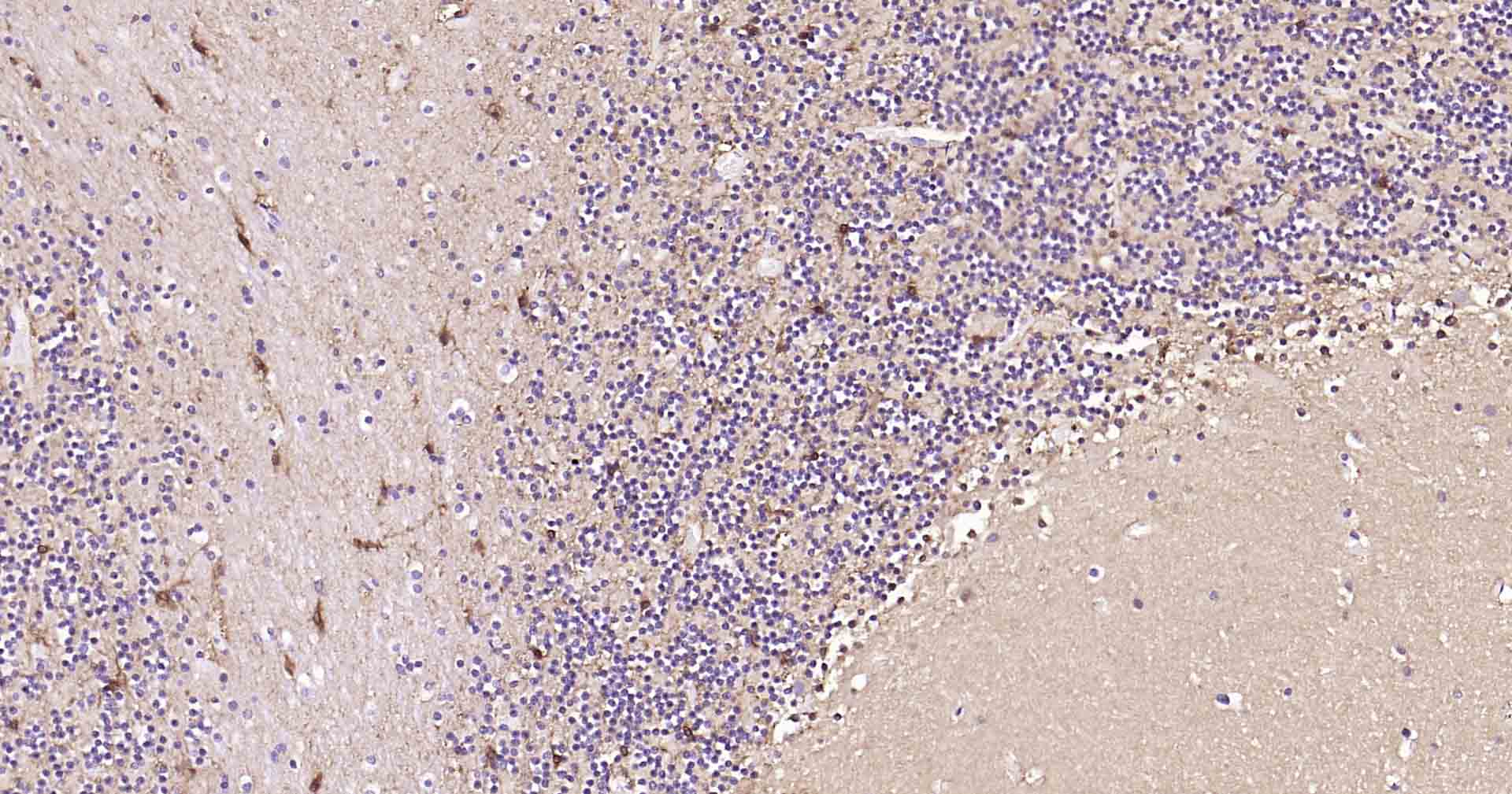 神经元特异性烯醇化酶/γ 烯醇化酶重组兔单克隆抗体