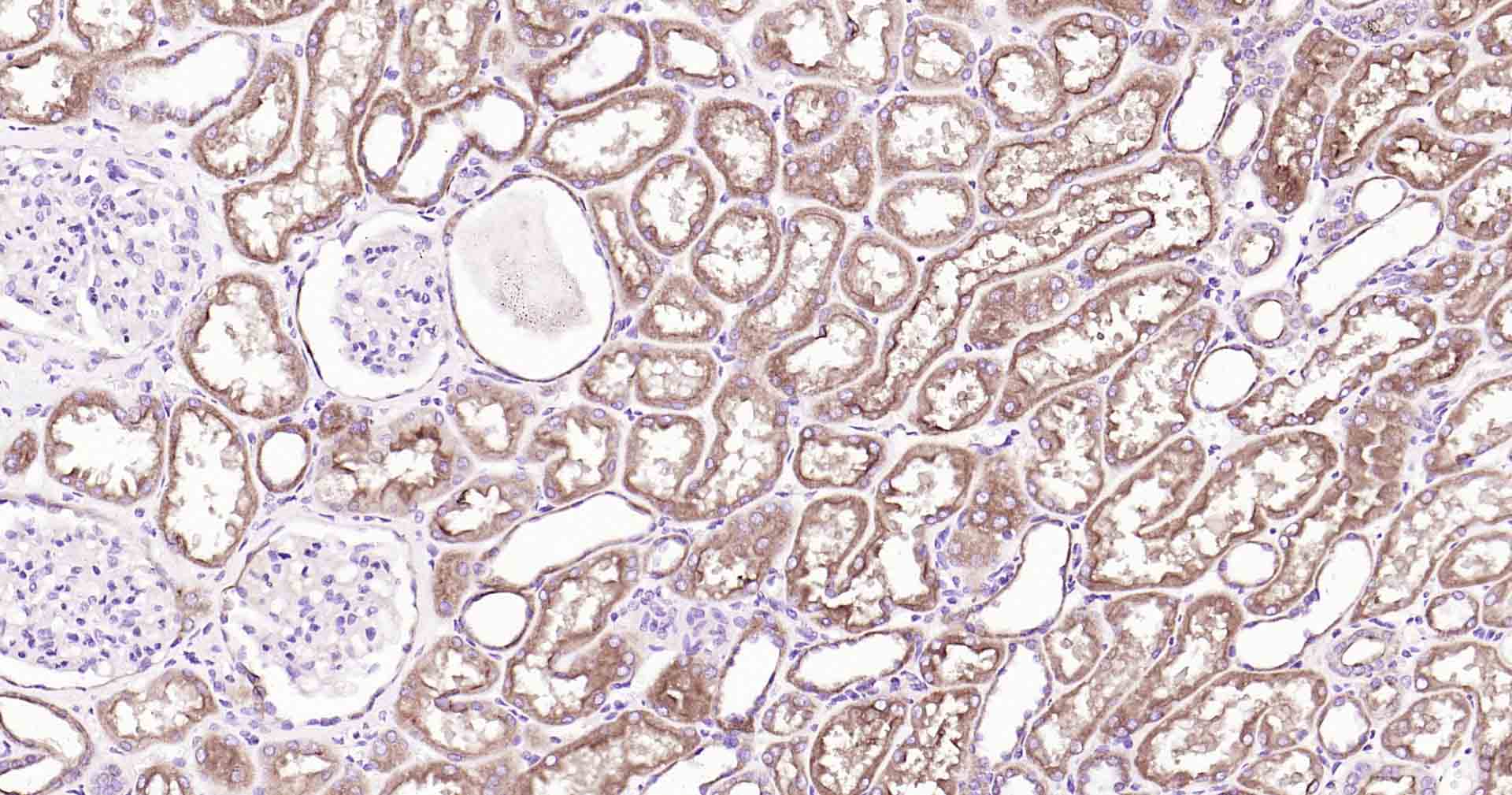 P-糖蛋白重组兔单克隆抗体