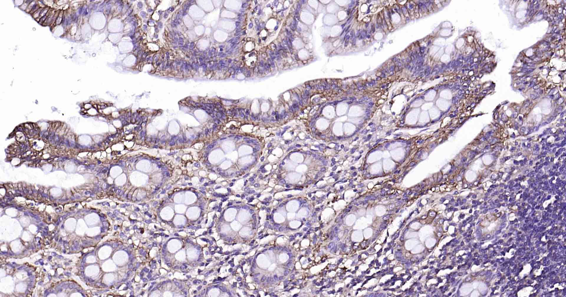 钠钾ATP酶蛋白a1单克隆抗体-bsm-34014M