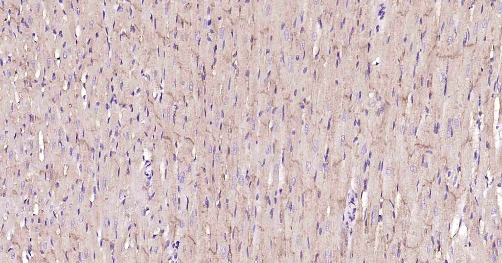 钠钾ATP酶蛋白b1重组兔单抗-bsm-61065R