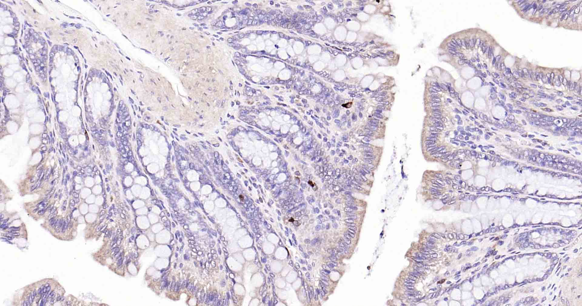 自噬效应蛋白Beclin 1重组兔单抗