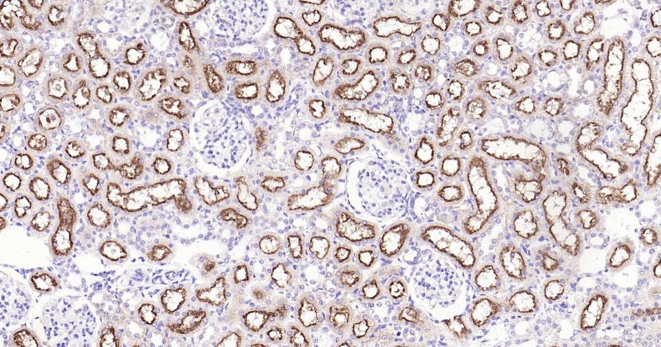 糖蛋白gp330重组兔单抗