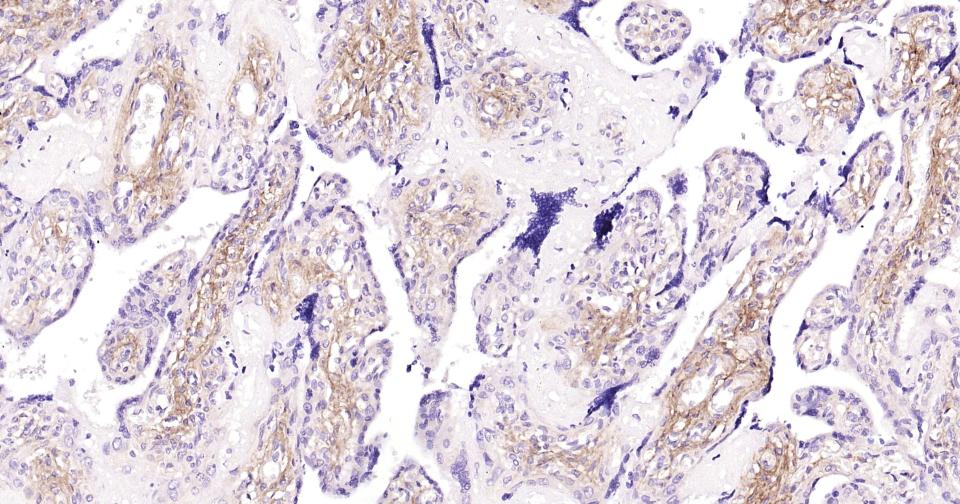 I型胶原单克隆抗体-bsm-33401M