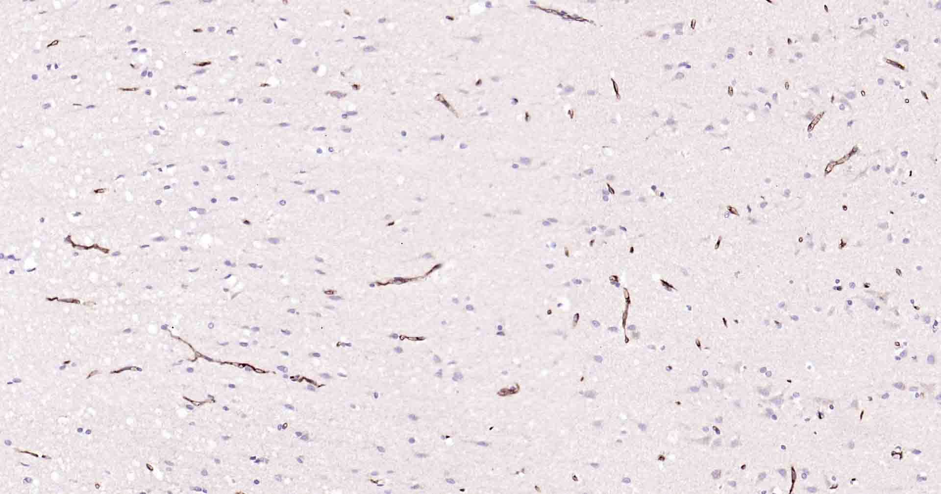 P-糖蛋白重组兔单克隆抗体