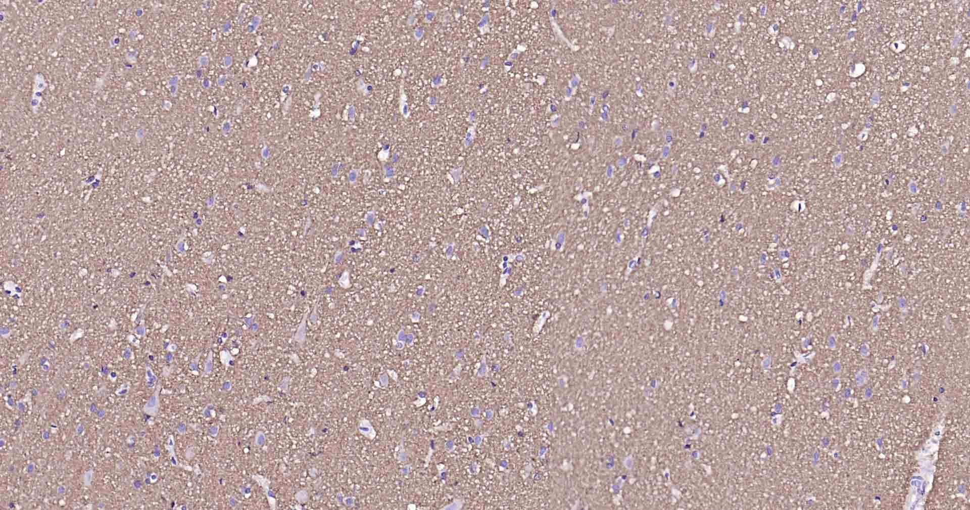 钠钾ATP酶蛋白a1单克隆抗体-bsm-34014M