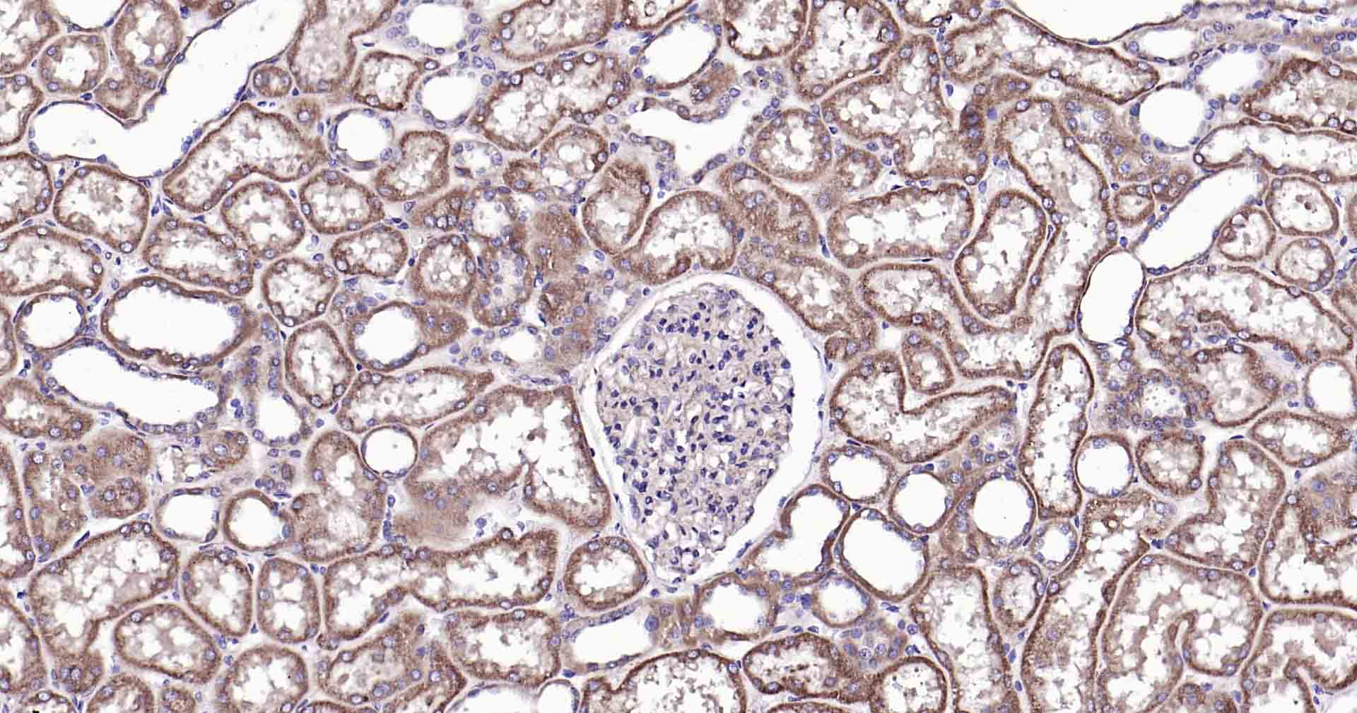 Ras样蛋白A重组兔单抗