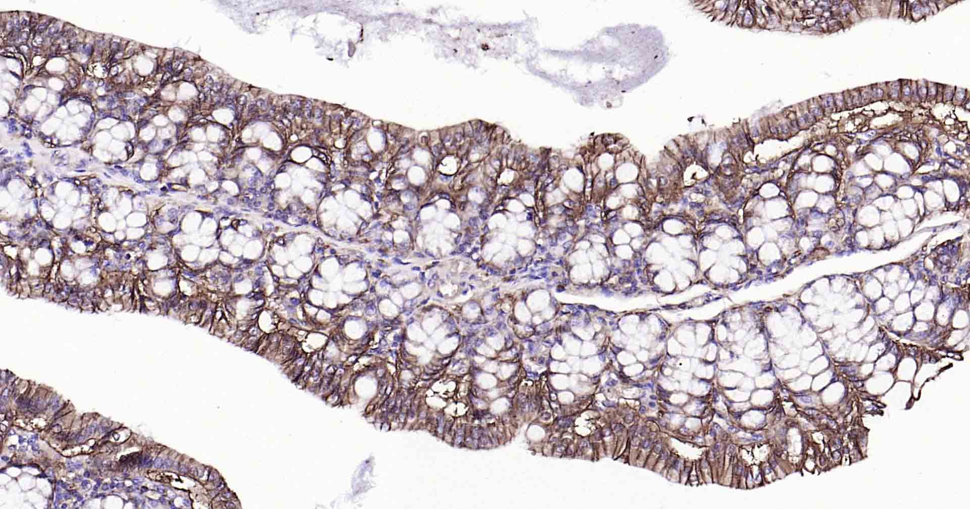 钠钾ATP酶蛋白a1单克隆抗体-bsm-34014M