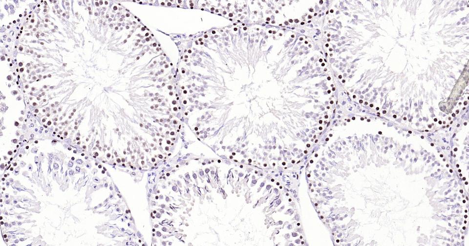增殖细胞核抗原（核内参）重组兔单抗