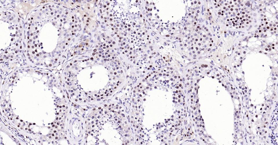 增殖细胞核抗原（核内参）重组兔单抗