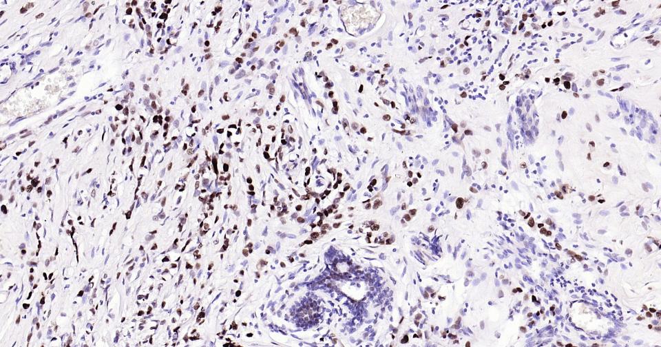 增殖细胞核抗原（核内参）重组兔单抗