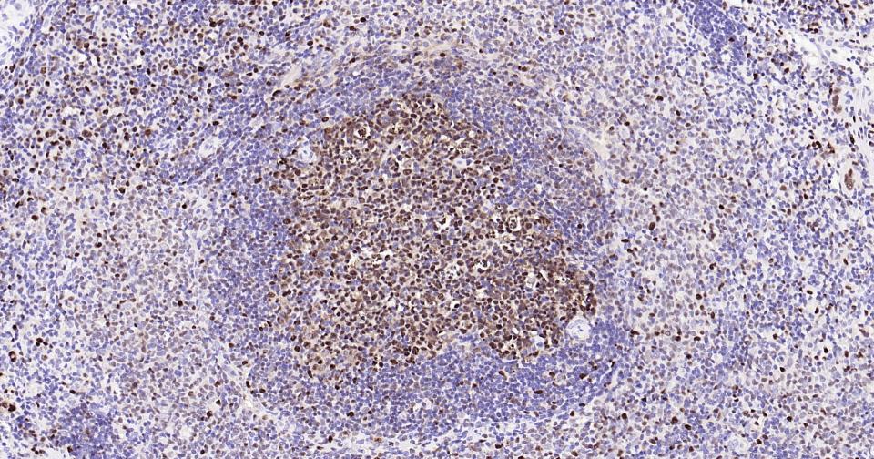 增殖细胞核抗原（核内参）重组兔单抗