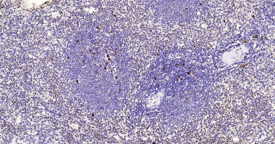 增殖细胞核抗原（核内参）重组兔单抗