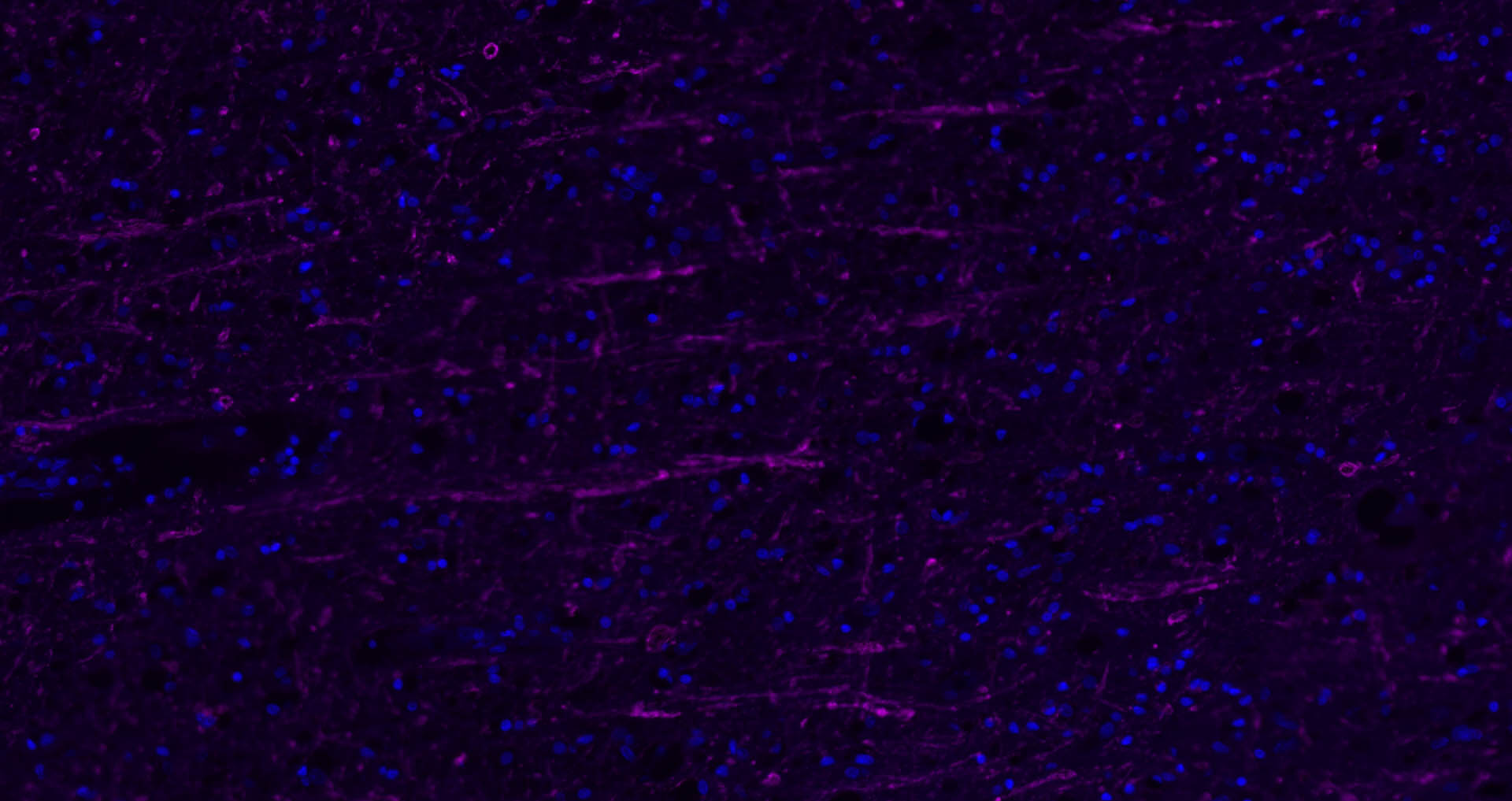 髓鞘碱性蛋白/磷脂碱性蛋白抗体-bs-0380R