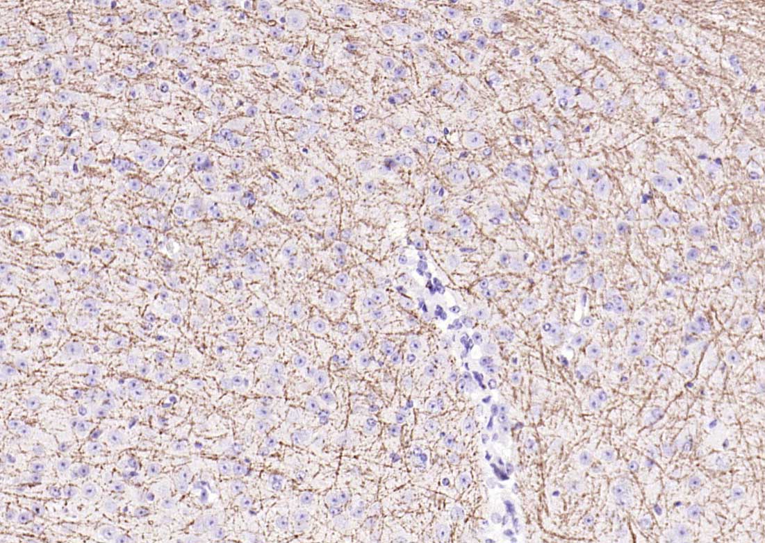 髓鞘碱性蛋白/磷脂碱性蛋白抗体-bs-0380R