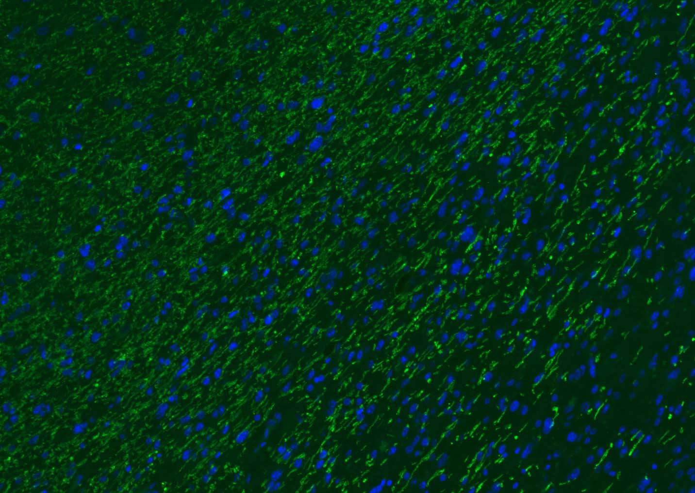 髓鞘碱性蛋白/磷脂碱性蛋白抗体-bs-0380R