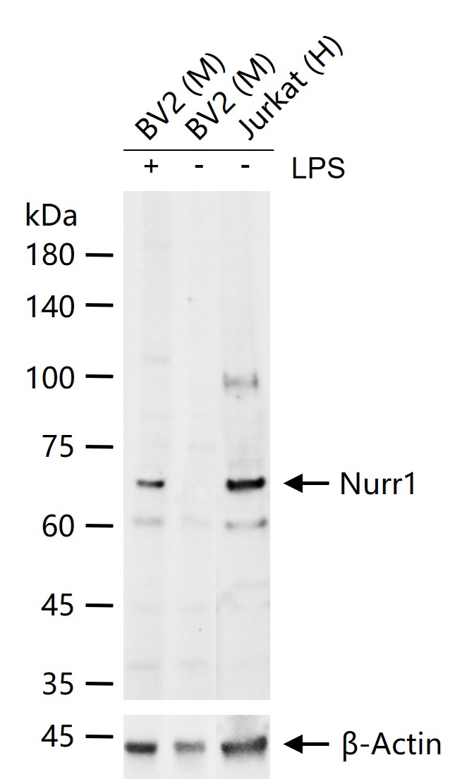 Nurr1 Rabbit pAb (一抗) - WB,IHC-P,IHC-F,IF | Bioss