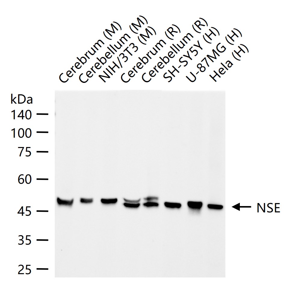 神经元特异性烯醇化酶/γ 烯醇化酶重组兔单克隆抗体