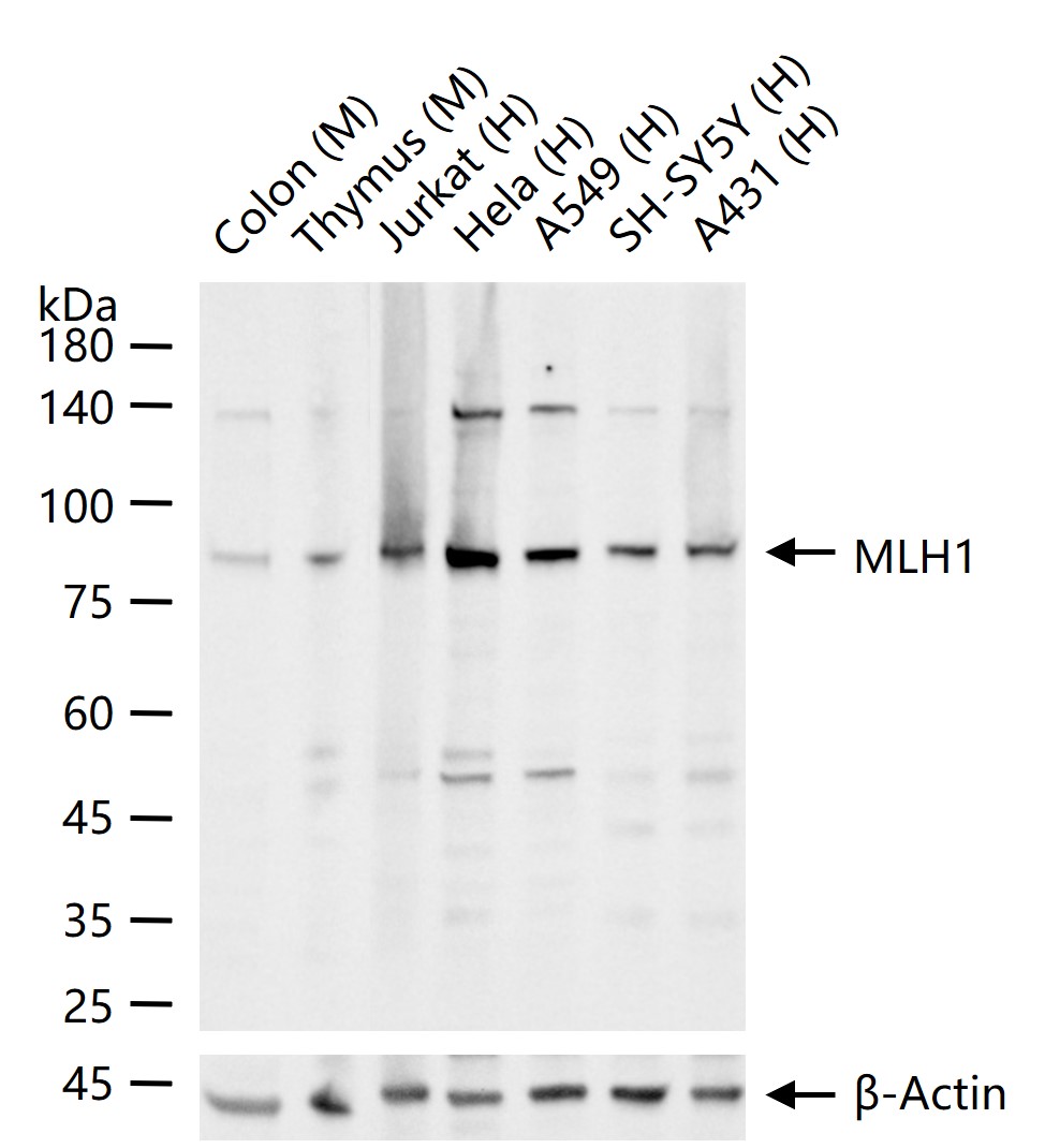 MLH1 Recombinant Rabbit mAb (一抗) | Bioss