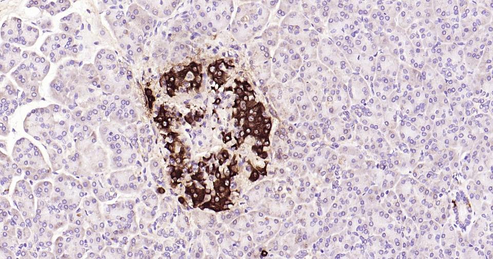 胰岛素重组兔单抗
