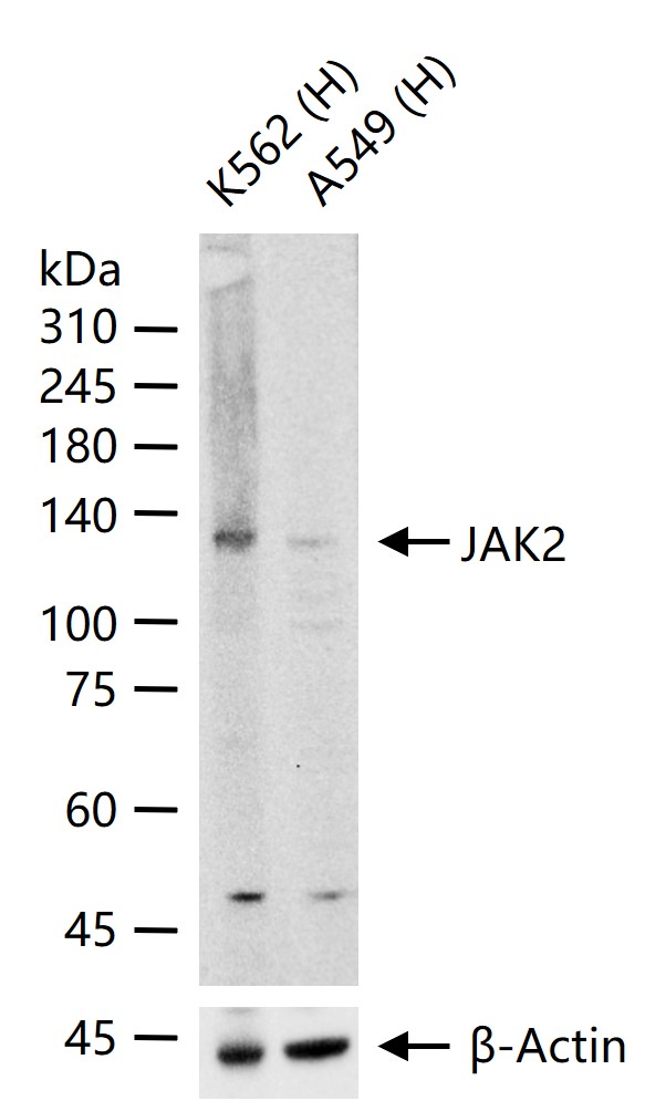 蛋白质酪氨酸激酶JAK2重组兔单抗