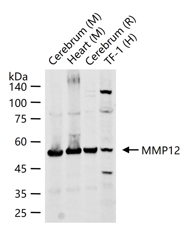 MMP12 Rabbit pAb (一抗) | Bioss