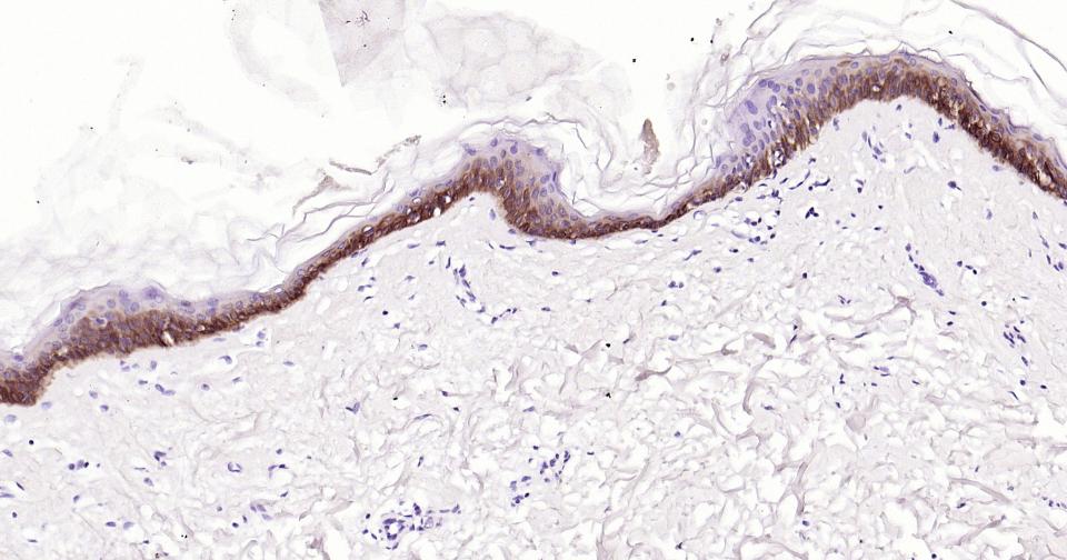细胞角蛋白5单克隆抗体-bsm-34181M