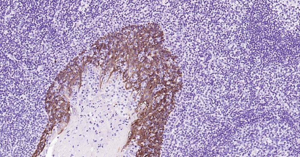 Cytokeratin 5 Mouse mAb (一抗) | Bioss