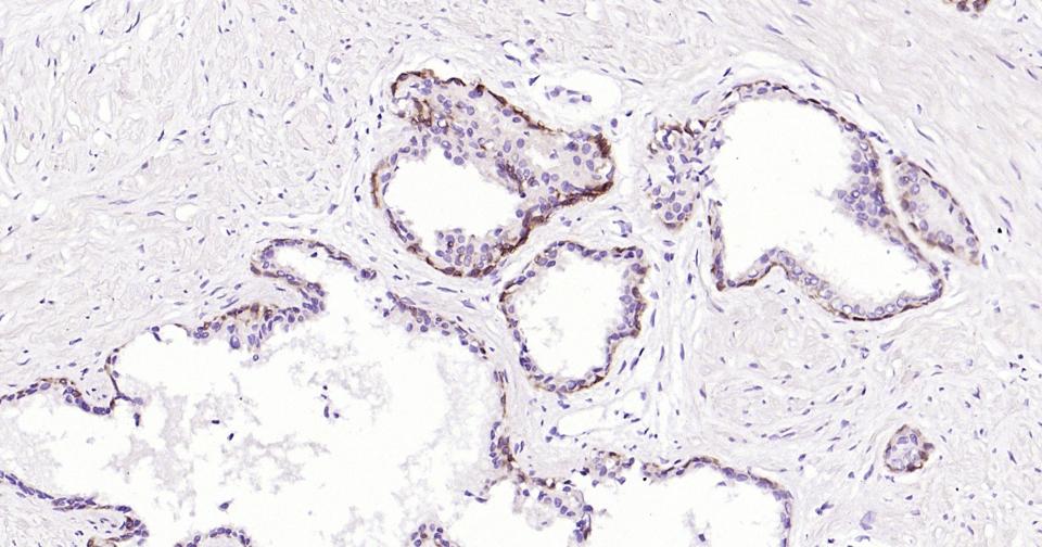 细胞角蛋白5单克隆抗体-bsm-34181M