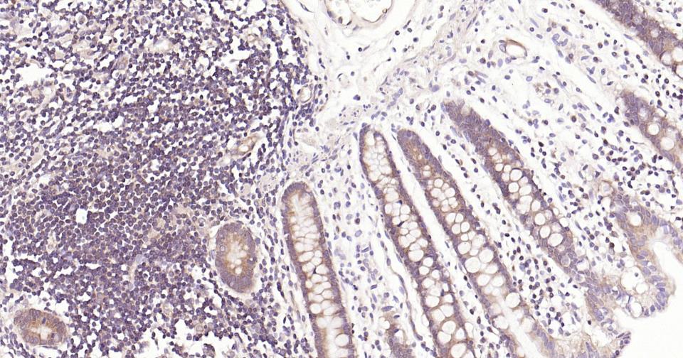 干扰素调节因子3重组兔单抗