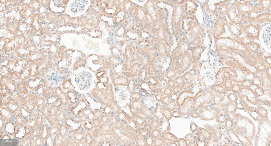 γ-氨基丁酸受体相关蛋白重组兔单抗