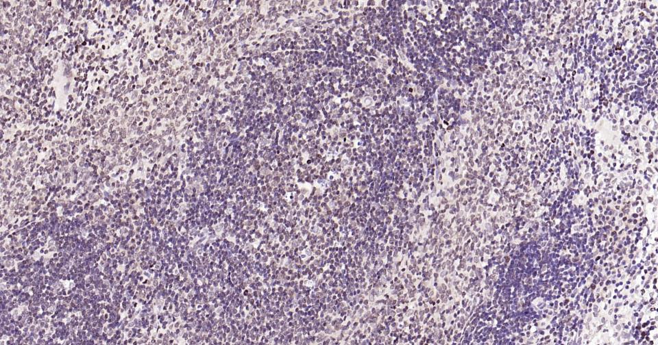 5-脂氧合酶重组兔单抗