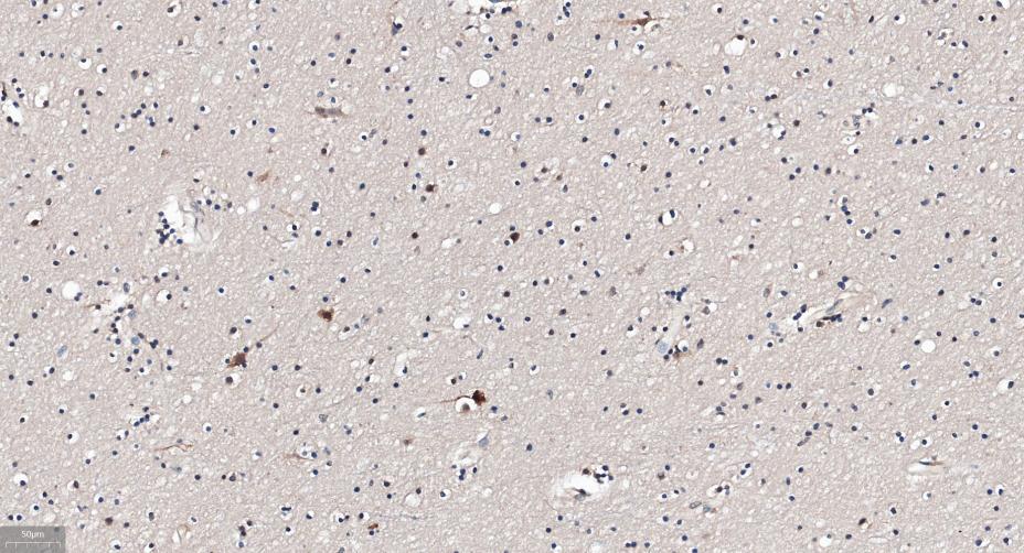 γ-氨基丁酸受体相关蛋白重组兔单抗