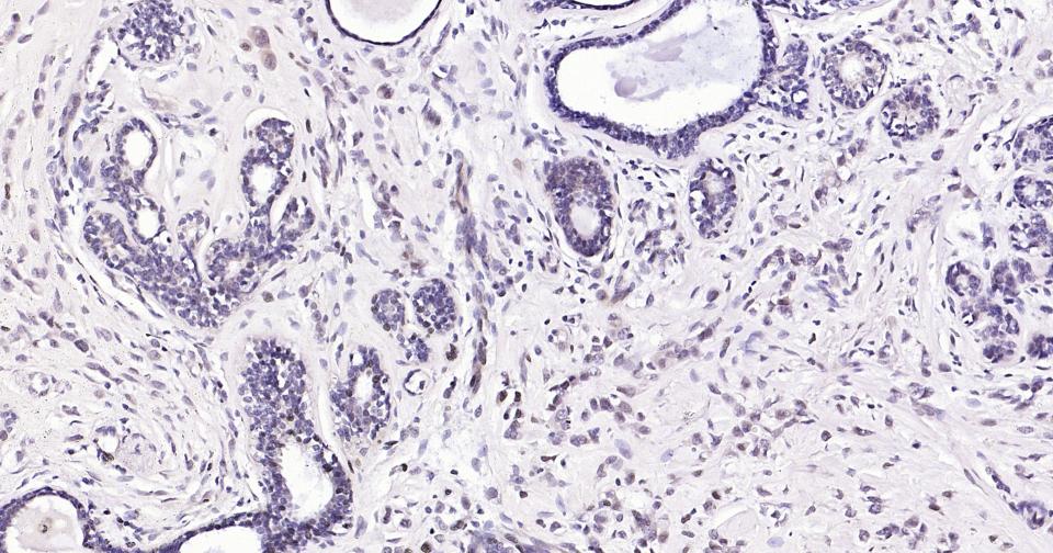 蛋白激酶B重组兔单抗