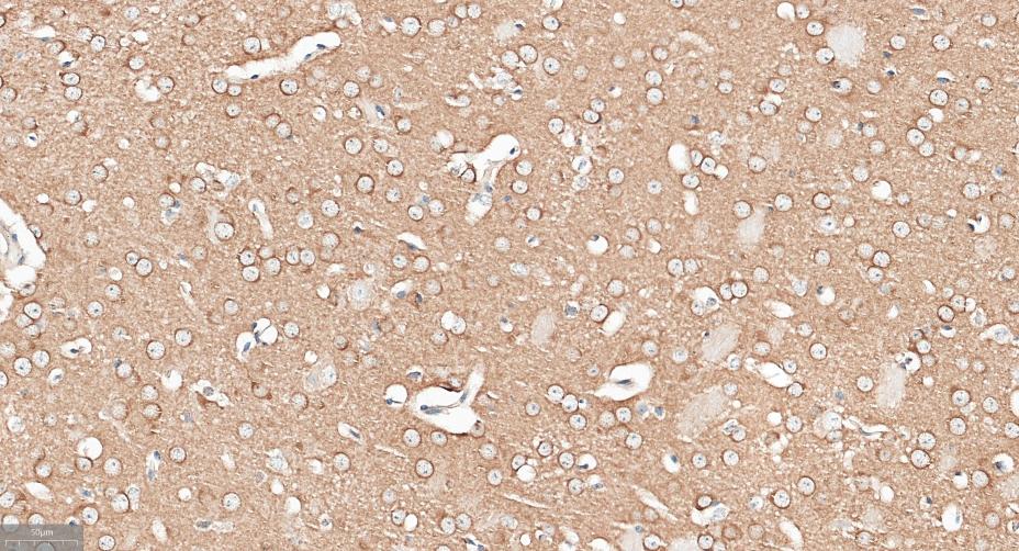 衔接因子蛋白含pH域蛋白1重组兔单抗