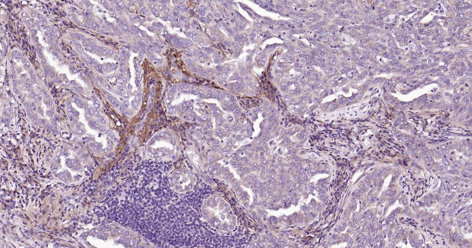 基质金属蛋白酶-12抗体-bs-1854R