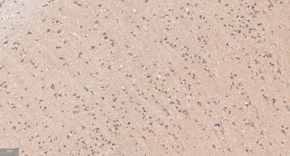 衔接因子蛋白含pH域蛋白1重组兔单抗