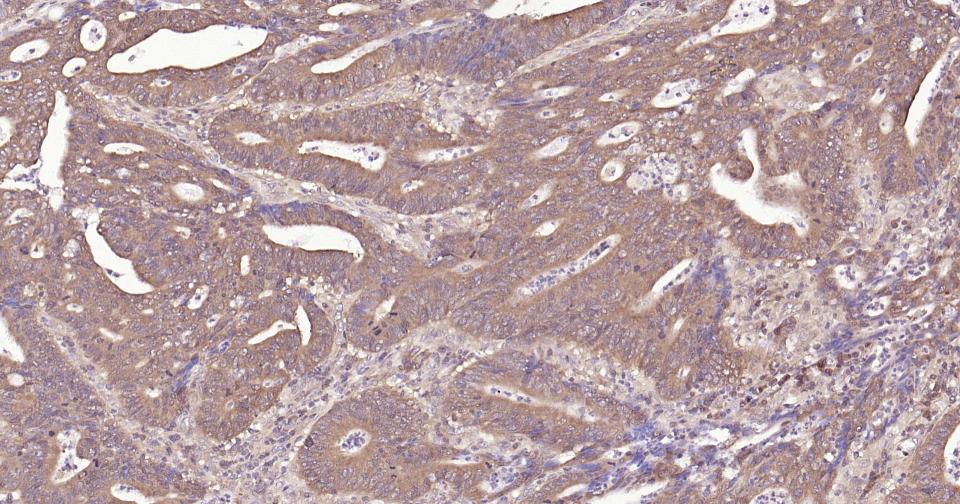 干扰素调节因子3重组兔单抗