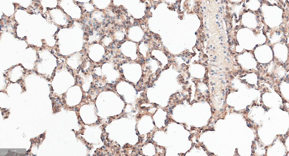 衔接因子蛋白含pH域蛋白1重组兔单抗