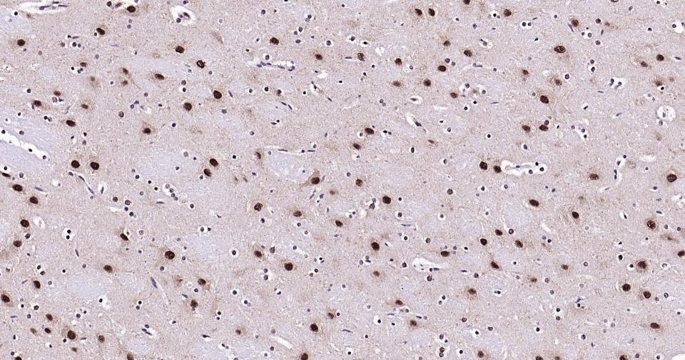 蛋白激酶B重组兔单抗